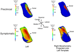 Frontiers | Network Neurodegeneration in Alzheimer’s Disease via MRI ...