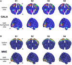 Frontiers | GALA: group analysis leads to accuracy, a novel approach ...