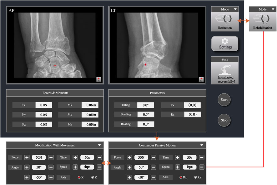 Colles' Fracture Reduction Trainer