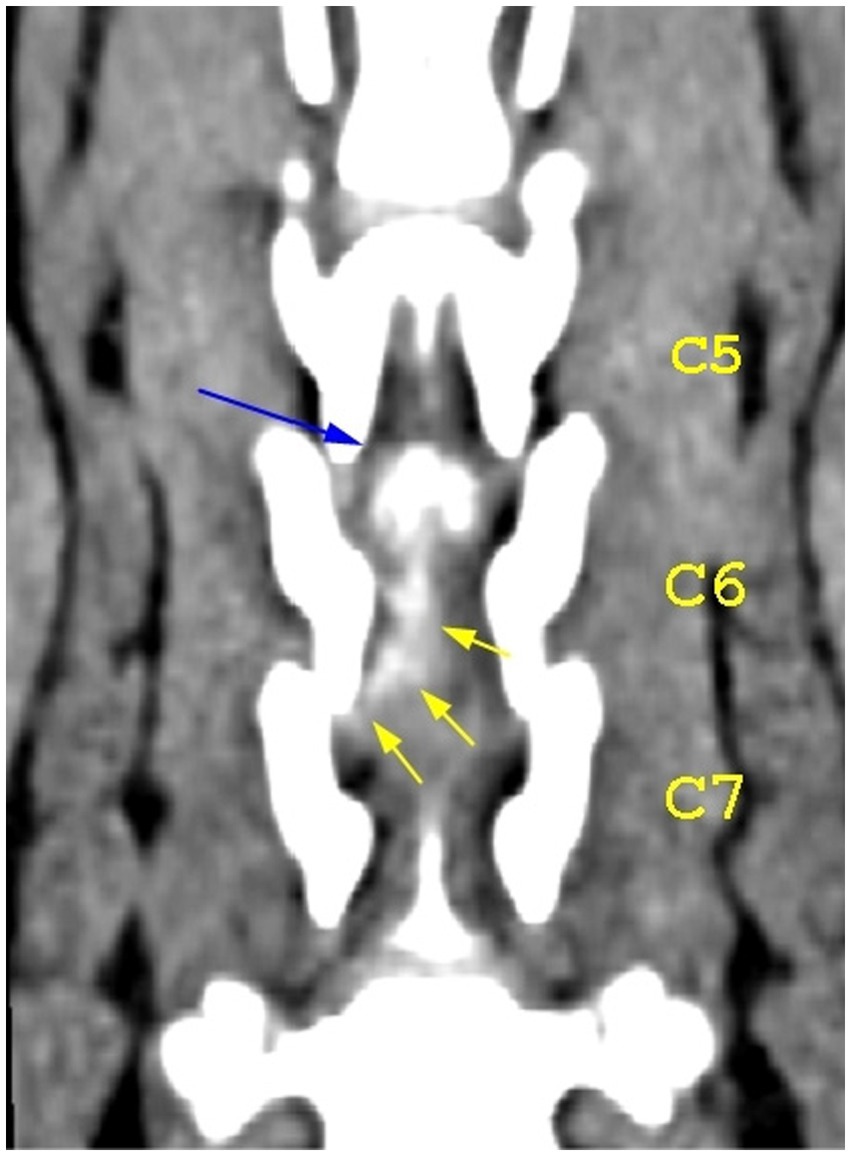 Frontiers | Case report: Double adjacent ventral slot in two medium ...