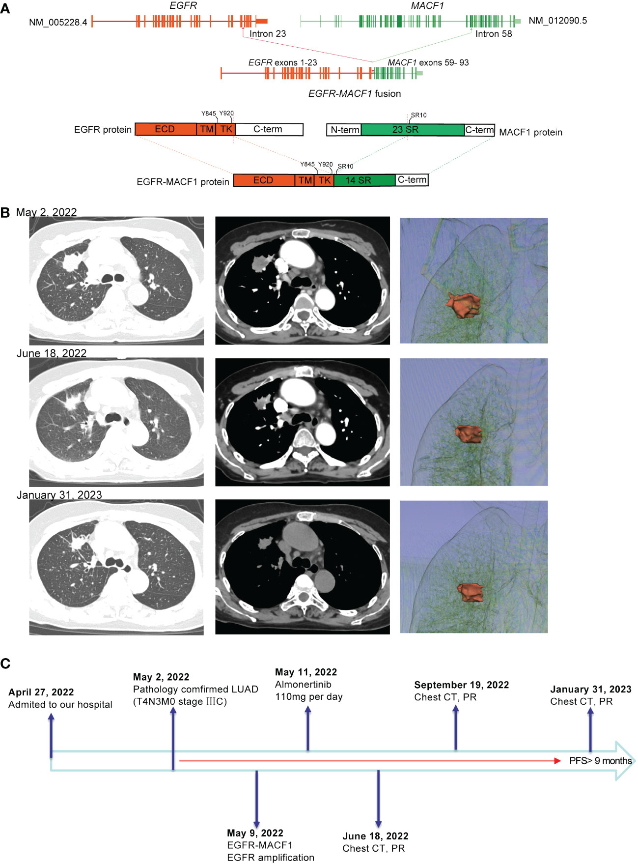 Frontiers | Case report: EGFR fusion mutation combined with EGFR ...