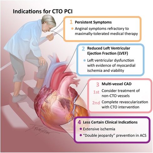 Frontiers  A non-interventional cardiologist's guide to coronary chronic  total occlusions