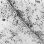 Frontiers | Nuclear entry of DNA viruses | Microbiology