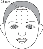 Frontiers | Non-contact measurement of facial surface vibration ...