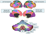 Frontiers | Cerebro-cerebellar circuits in autism spectrum disorder ...