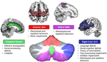 Frontiers | Cerebro-cerebellar circuits in autism spectrum disorder ...