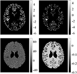 Frontiers | Positive Unanimous Voting Algorithm for Focal Cortical ...