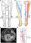 Frontiers | Commentary: Differential Cerebral Response to Somatosensory ...