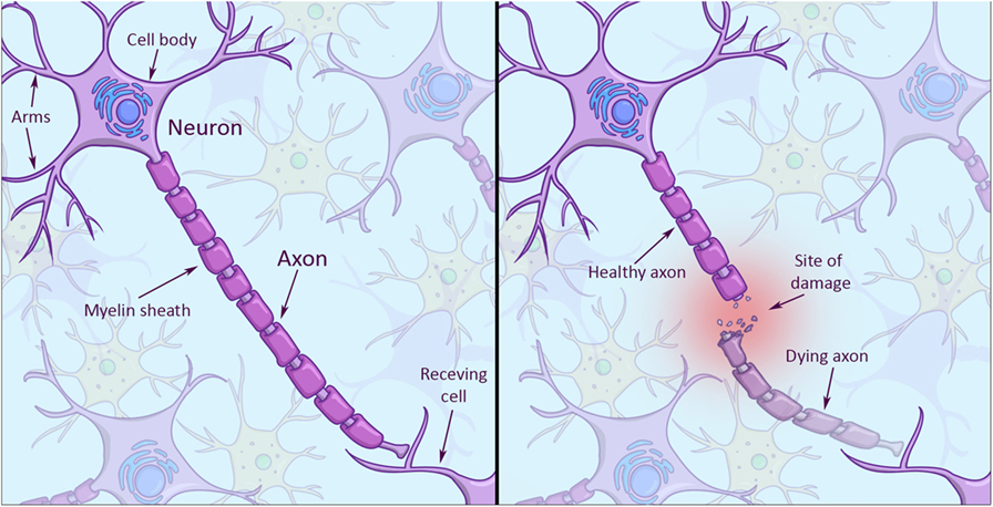 Why Doesn t Your Brain Heal Like Your Skin Frontiers For Young Minds