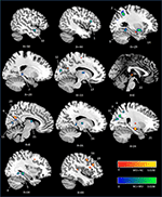 Frontiers A Meta Analysis Of Cognitive Impairment And Decline