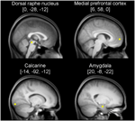 Frontiers | Dorsal Raphe Nucleus Down-Regulates Medial Prefrontal ...