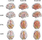 Frontiers | Structural Brain Network Reorganization and Social ...