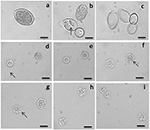 Frontiers | Inhibitory Effects of Macrotetrolides from Streptomyces spp ...