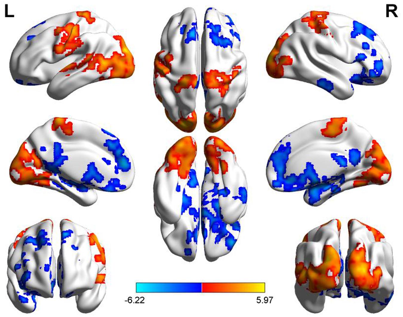 Frontiers  Diurnal Variations in Neural Activity of Healthy Human