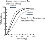 Frontiers | How Should Oxygen Supplementation Be Guided by Pulse ...