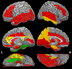 Frontiers | Increased Water Diffusion in the Parcellated Cortical ...