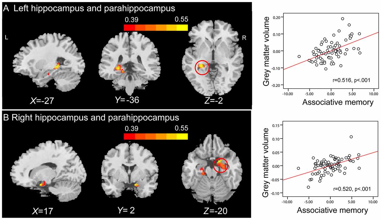 Frontiers Sex Matters Hippocampal Volume Predicts Individual