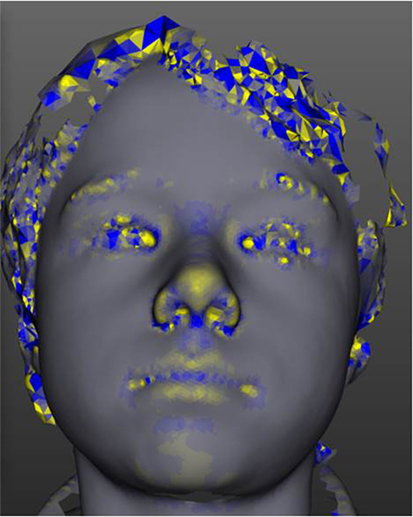 Frontiers 3 Dimensional Facial Analysis—facing Precision Public Health