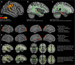 Frontiers | Cognitive Variability during Middle-Age: Possible ...