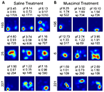 Frontiers | Inactivation of the Lateral Entorhinal Area Increases the ...