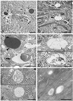 Frontiers | Ultrastructural Changes during the Life Cycle of Mycoplasma ...