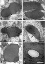 Frontiers | Ultrastructural Changes during the Life Cycle of Mycoplasma ...