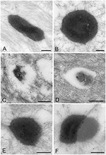 Frontiers | Ultrastructural Changes during the Life Cycle of Mycoplasma ...