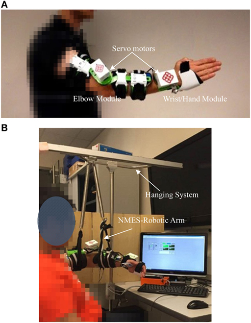 Frontiers Early Stroke Rehabilitation Of The Upper Limb Assisted With An Electromyography