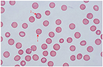 Frontiers | First Molecular Detection of Babesia gibsoni in Dogs from ...