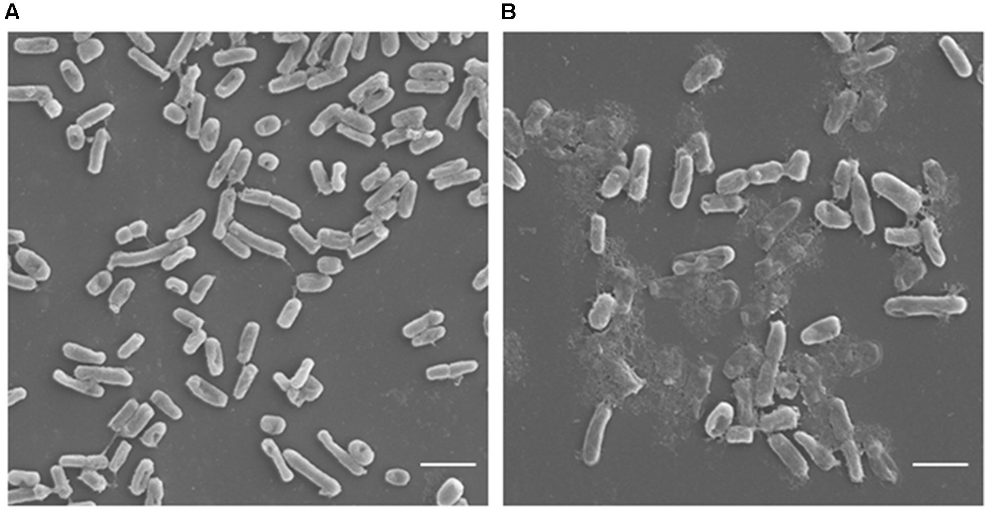 Escherichia coli under microscope 100x