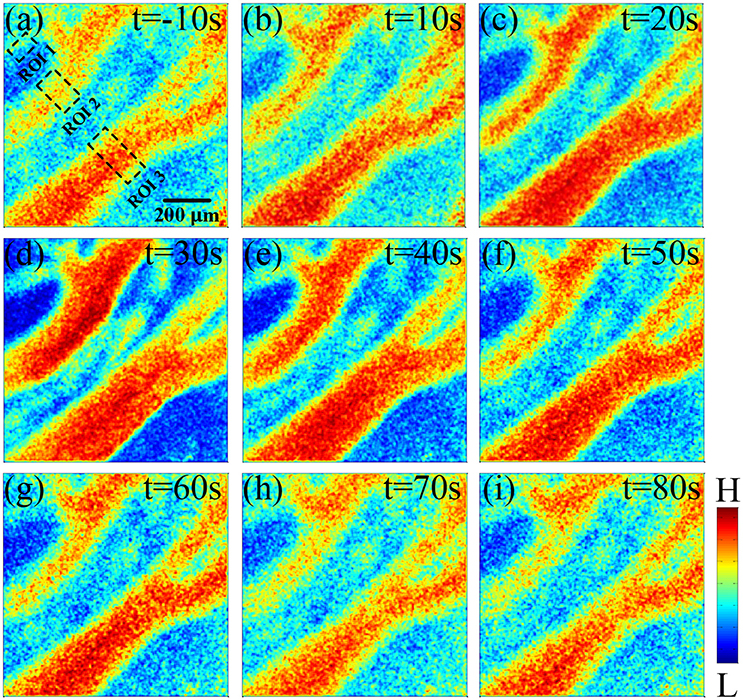 Frontiers | Cortical Hemodynamic Responses Under Focused Ultrasound ...