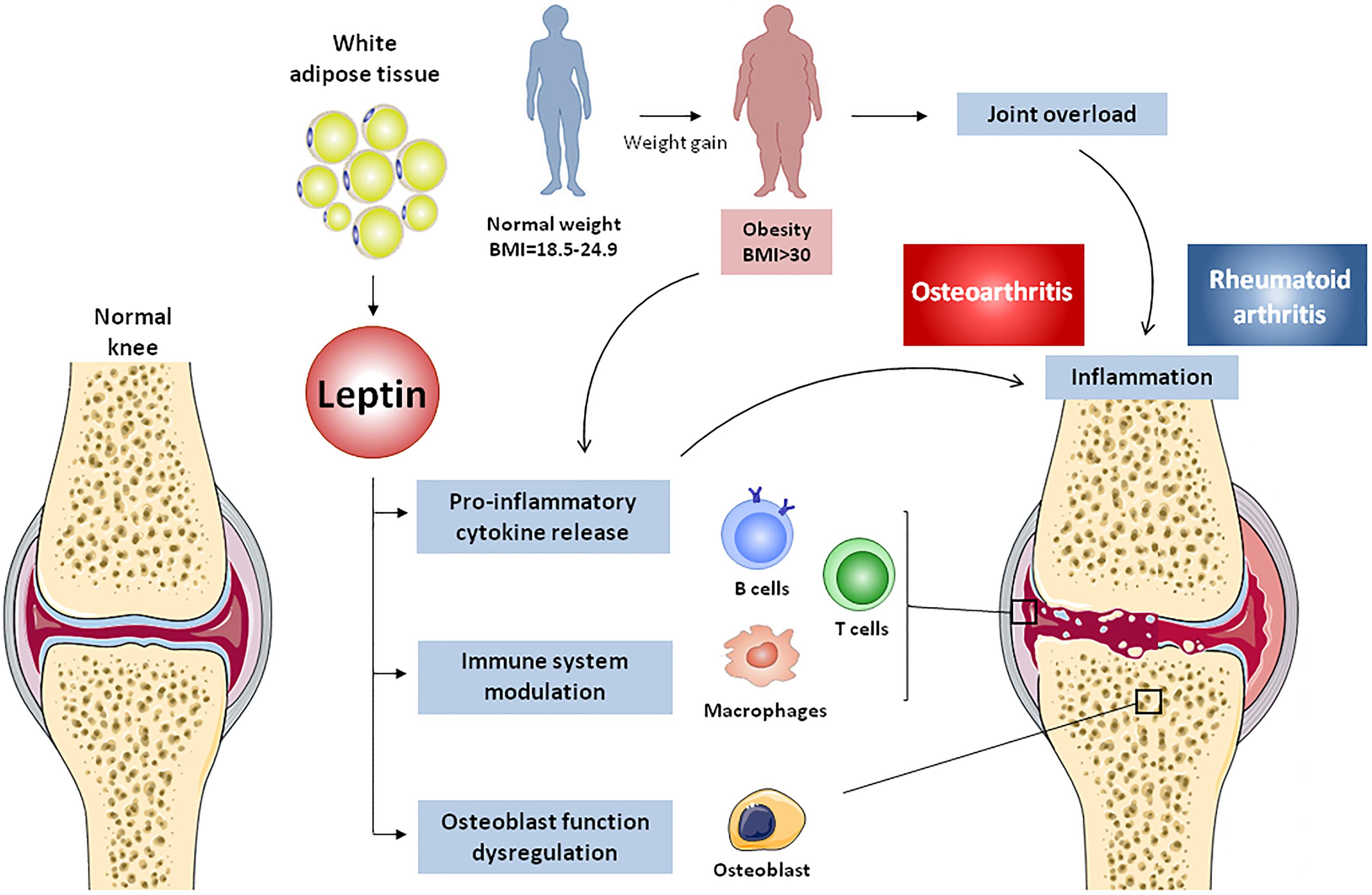 Frontiers Obesity Fat Mass And Immune System Role For Leptin