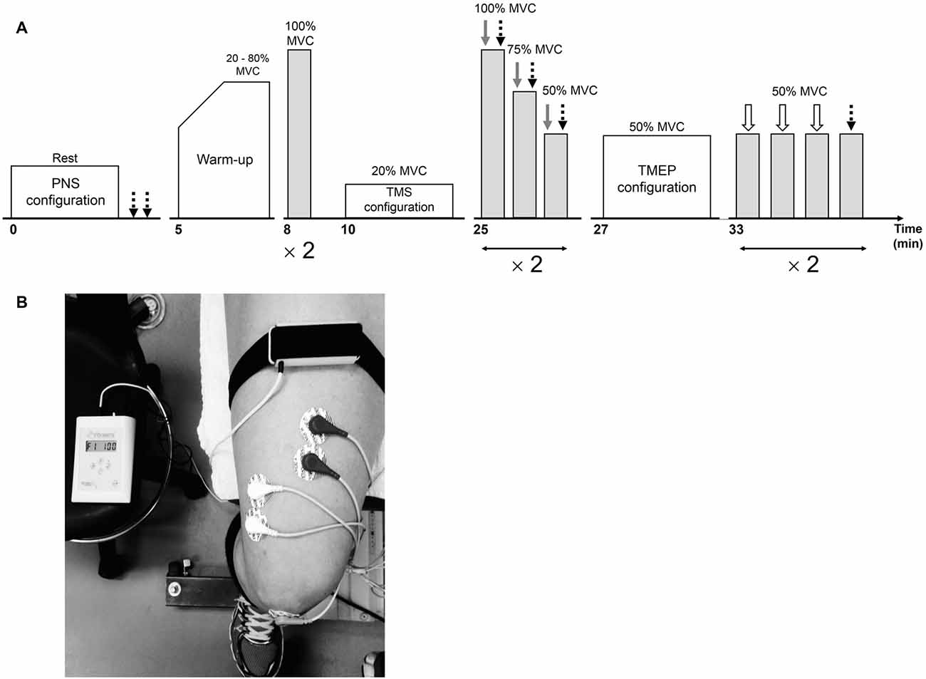 Acute effects of neuromuscular electrical stimulation on cortical dynamics  and reflex activation