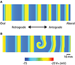 Frontiers | Progress In Mathematical Modeling Of Gastrointestinal Slow ...