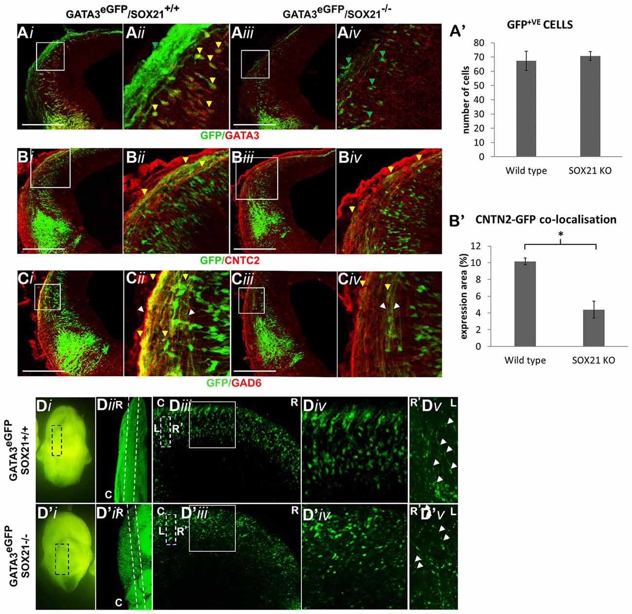 Frontiers | Sequential Role of SOXB2 Factors in GABAergic Neuron ...