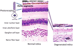 Frontiers | Are Anti-Retinal Autoantibodies a Cause or a Consequence of ...