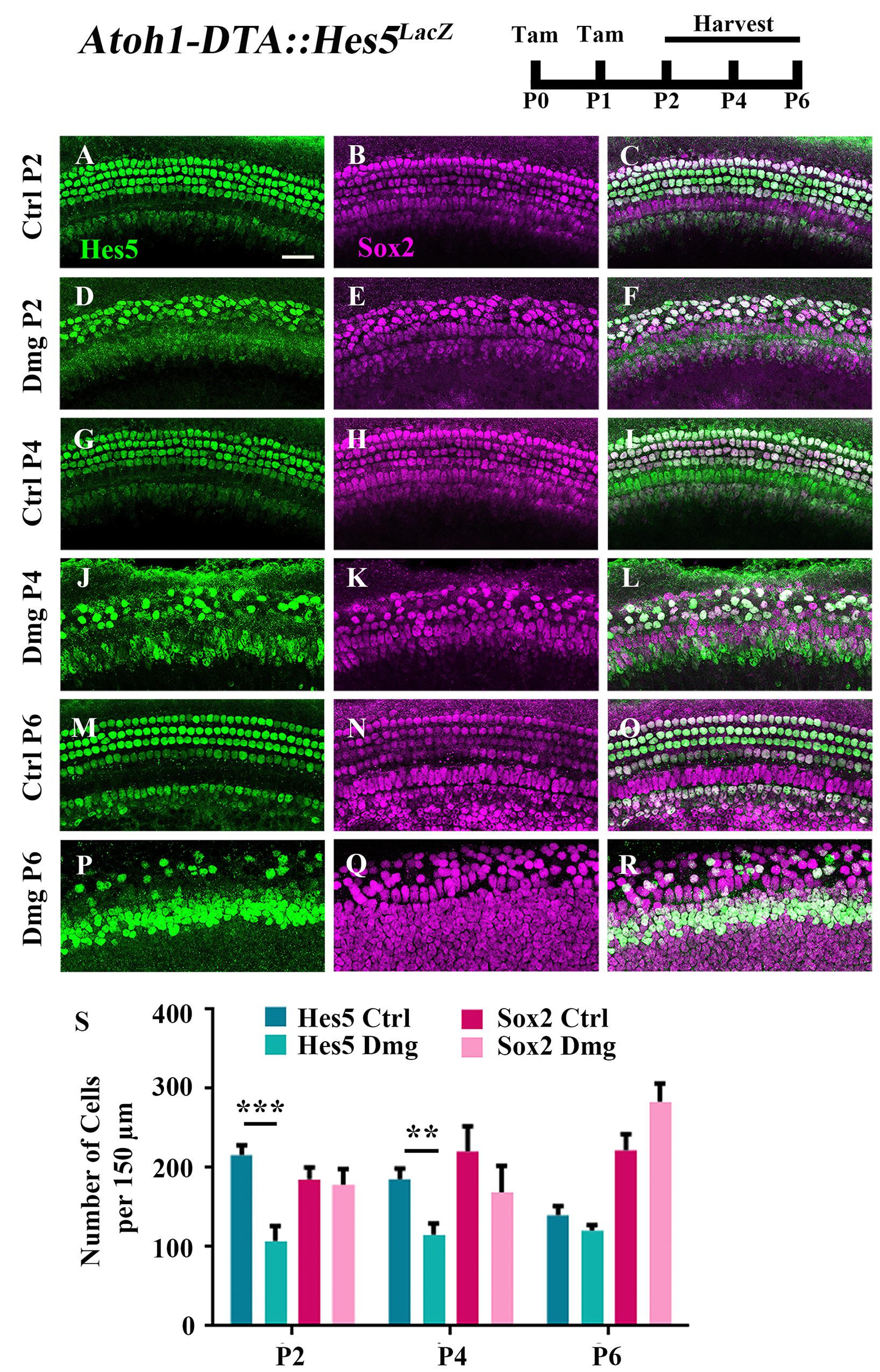 Molecule Required for the Regeneration of Auditory<br/>Hair Cells