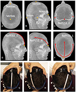 Frontiers | MRI-Guided Regional Personalized Electrical Stimulation in ...