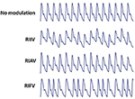 Frontiers | Extracting Instantaneous Respiratory Rate From Multiple ...