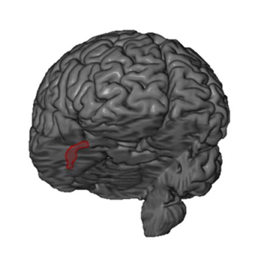 图1 -在这个图中,您正在查看的大脑,如果你看那个人的脸。