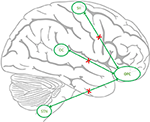 Frontiers | Cortical and Subcortical Alterations in Medication Overuse ...