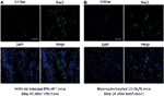 Frontiers | S100a4 Is Secreted by Alternatively Activated Alveolar ...