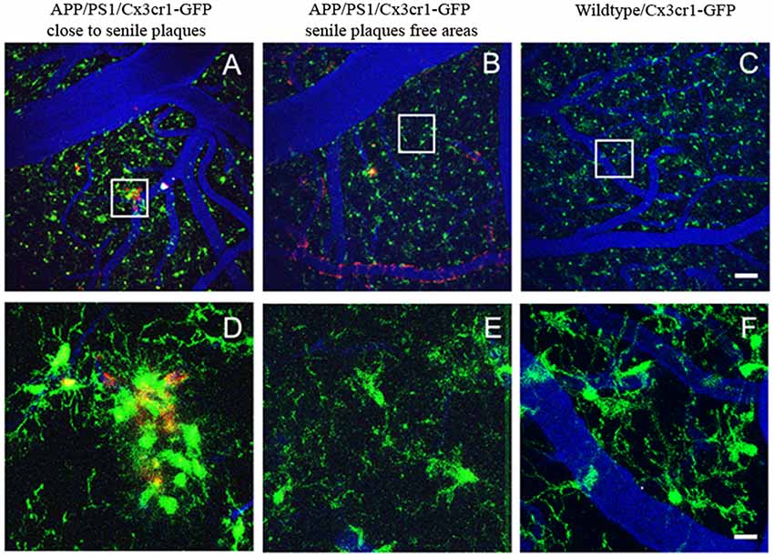 Frontiers | In Vivo Imaging of Microglia With Multiphoton Microscopy