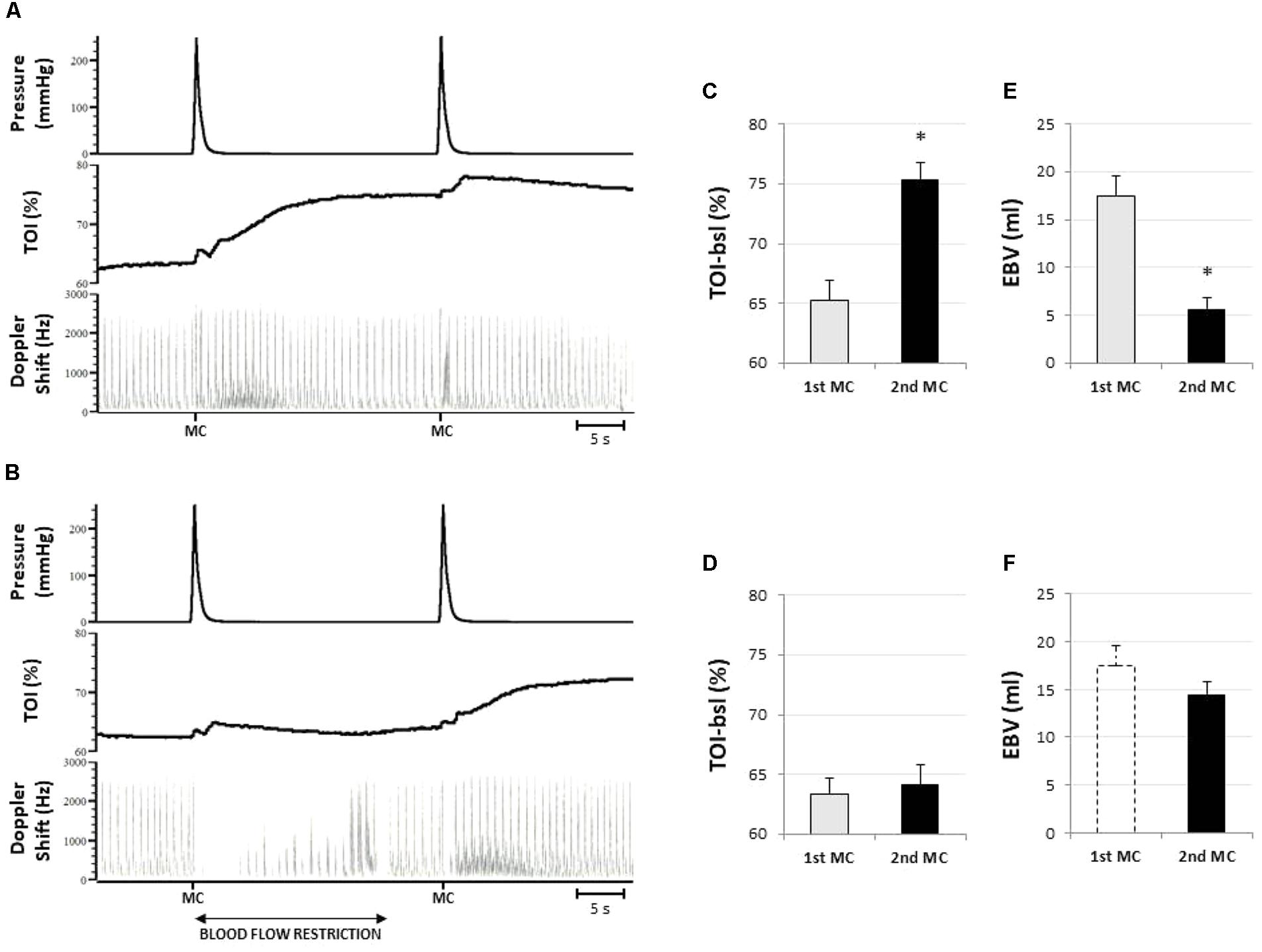 Frontiers | Hyper-Oxygenation Attenuates The Rapid Vasodilatory ...