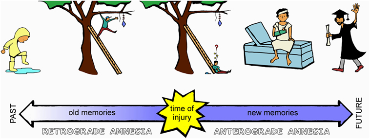 anterograde amnesia vs retrograde amnesia quizlet