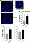 Frontiers | A Single Dose Of 5-MeO-DMT Stimulates Cell Proliferation ...