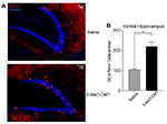 Frontiers | A Single Dose Of 5-MeO-DMT Stimulates Cell Proliferation ...