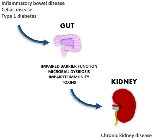 Frontiers The Gut Kidney Axis Putative Interconnections Between Gastrointestinal And Renal Disorders Endocrinology