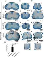 Frontiers | Intracranial Inoculation Is More Potent Than Intranasal ...