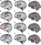 Frontiers | Designing Brains for Pain: Human to Mollusc | Physiology